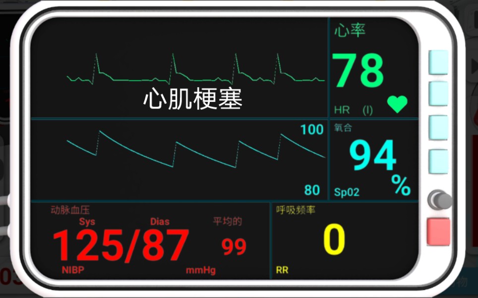 [图]现实医疗模拟器：心肌梗塞