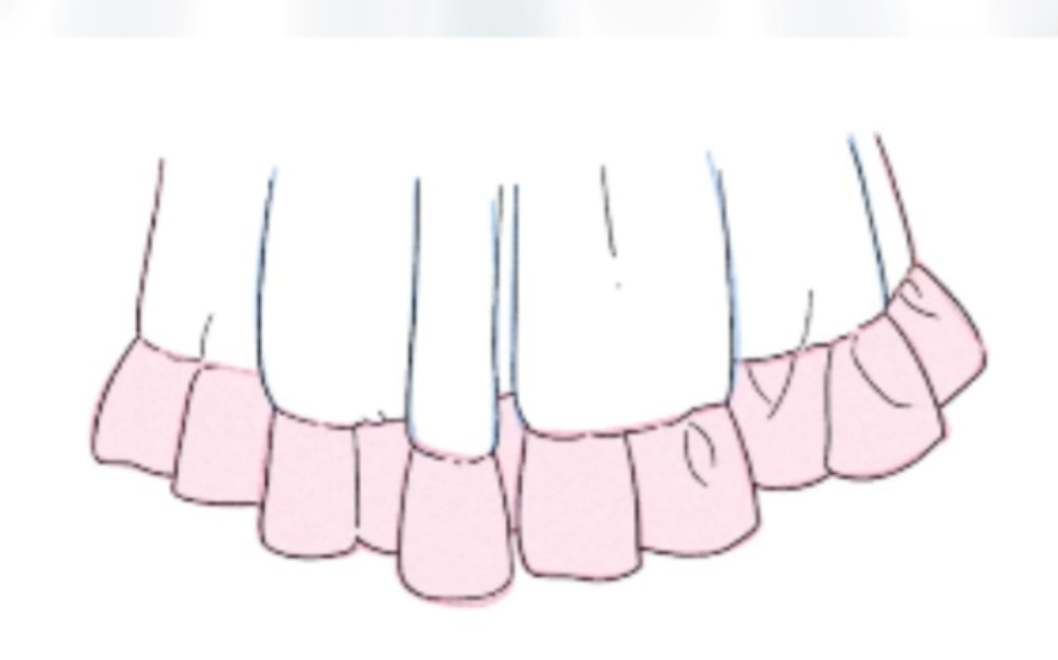 裙褶皱画法哔哩哔哩bilibili