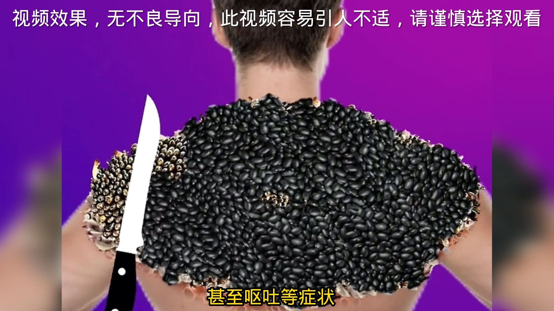 知识科普:密集恐惧症2.