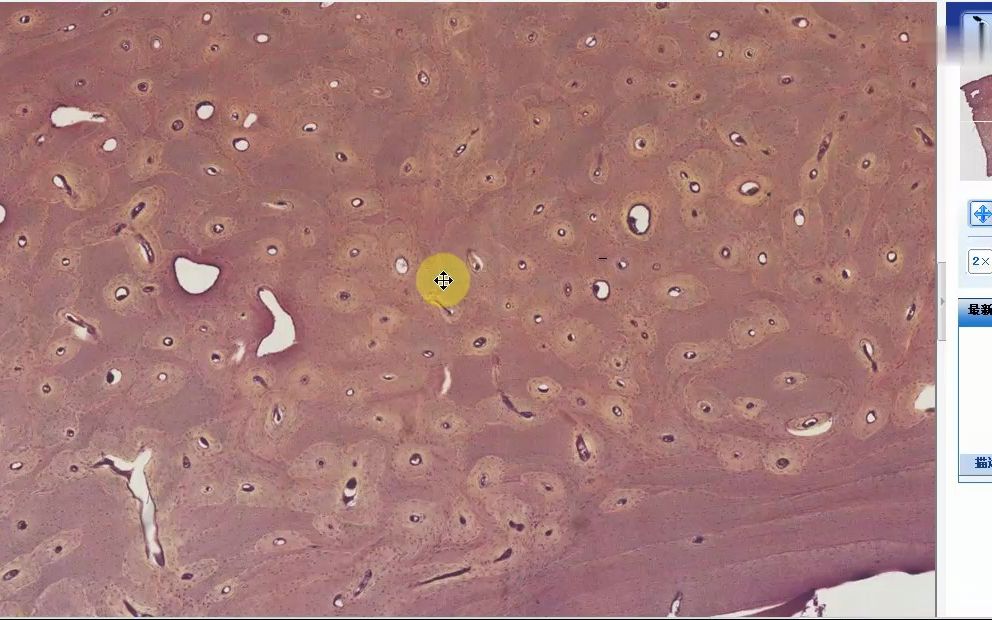 4.15]--5.4骨切片-6#切片