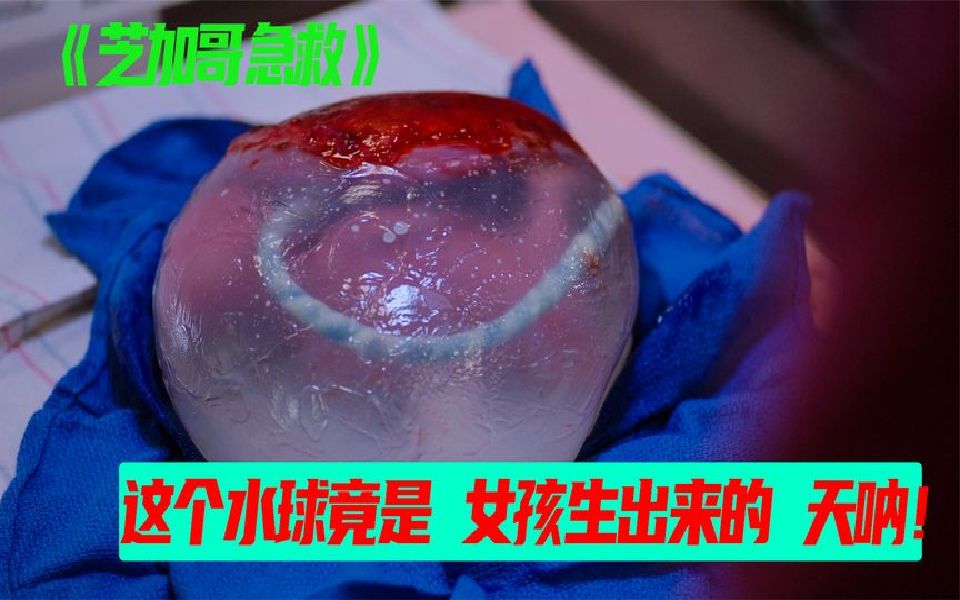 [图]医疗故事 别人分娩生的都是孩子，可今天医生却接出了个球体！