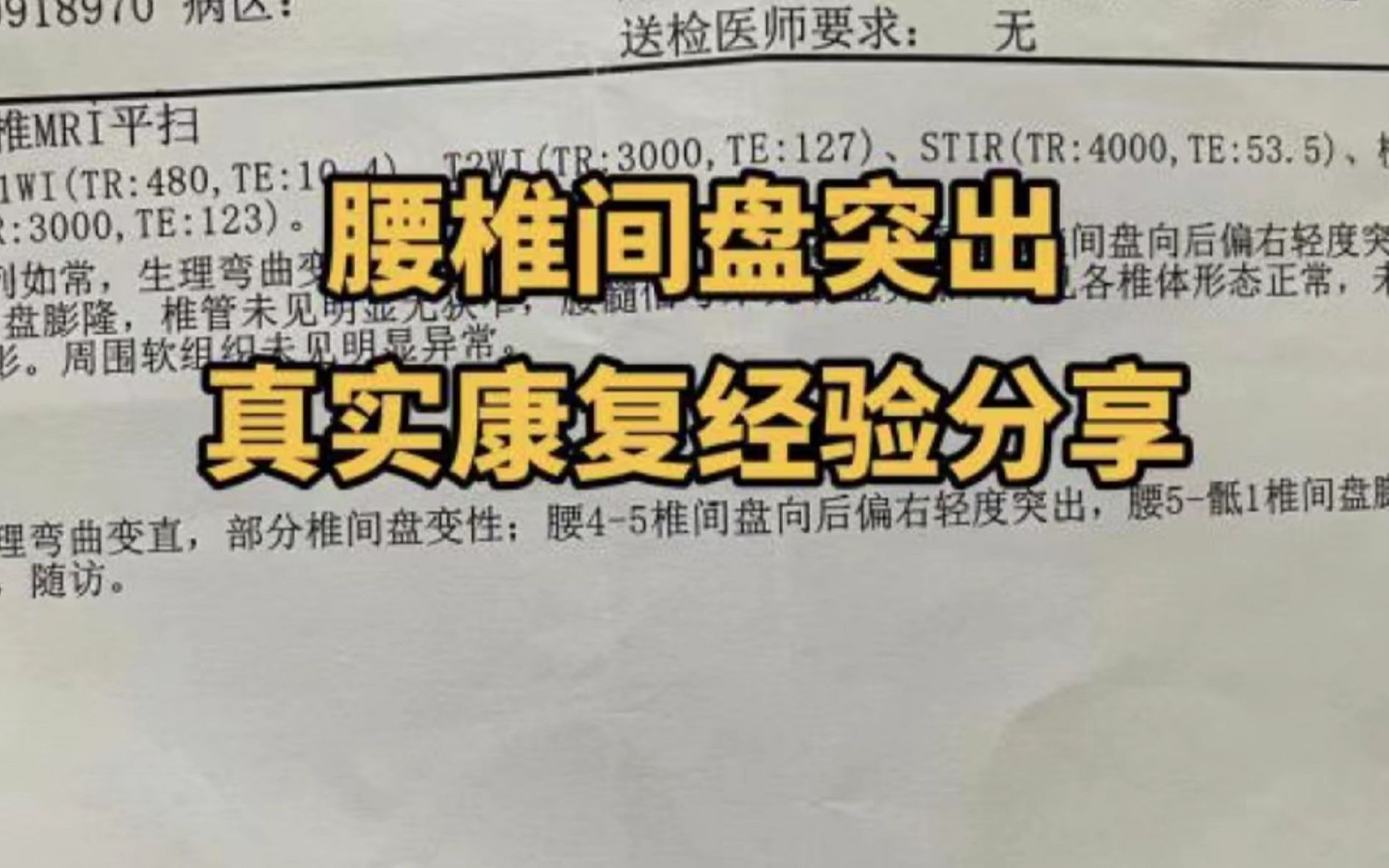 腰间盘突出居家治疗法细节曝光,1月根治不复发,不看太可惜了!哔哩哔哩bilibili