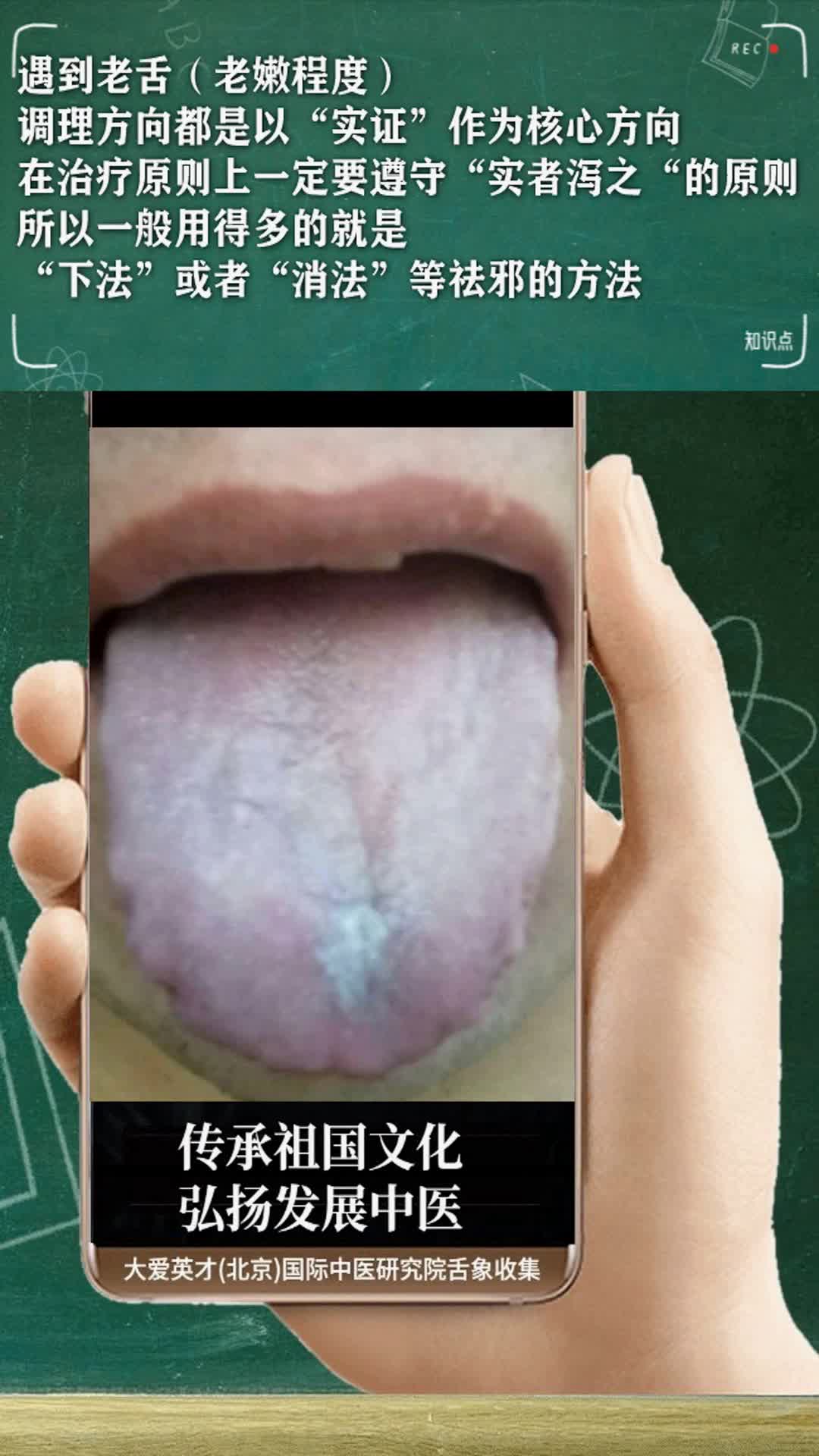 舌诊知识:黑苔舌,肾寒,郁陷,心气空虚