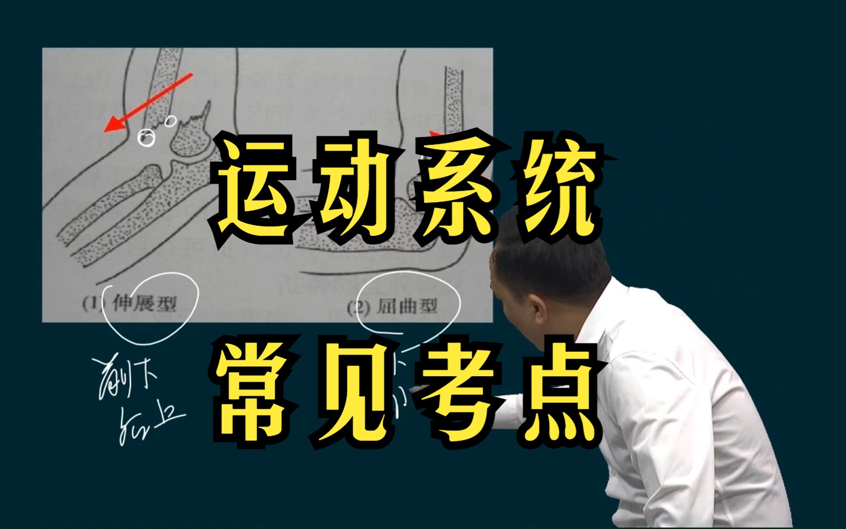 肱骨髁上骨折常见考点:骨折线伸直型前下后上,屈曲型前上后下!东帆老师速记:要值钱,就下海哔哩哔哩bilibili