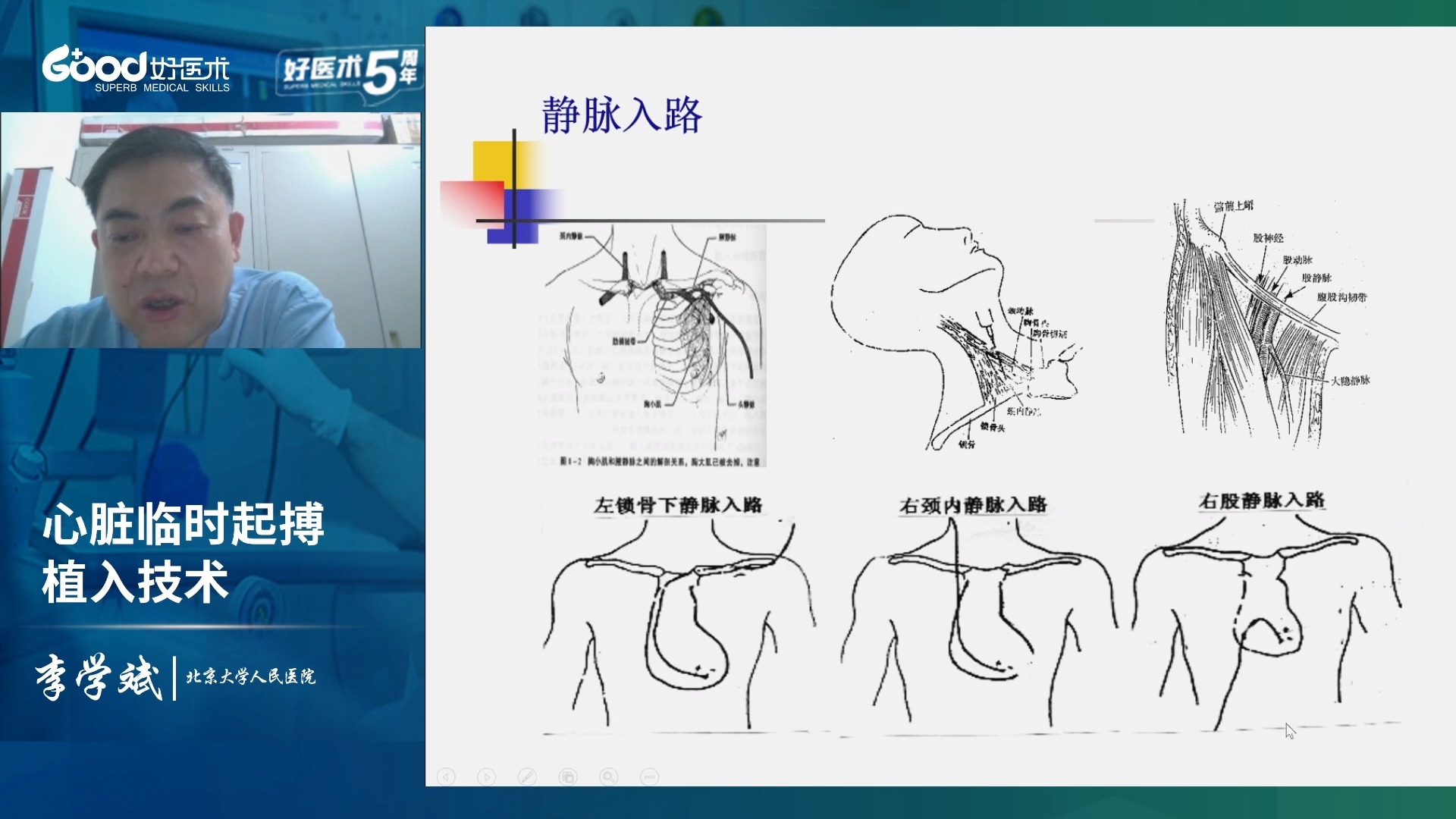 第2课时  心脏临时起搏植入技术试听课哔哩哔哩bilibili