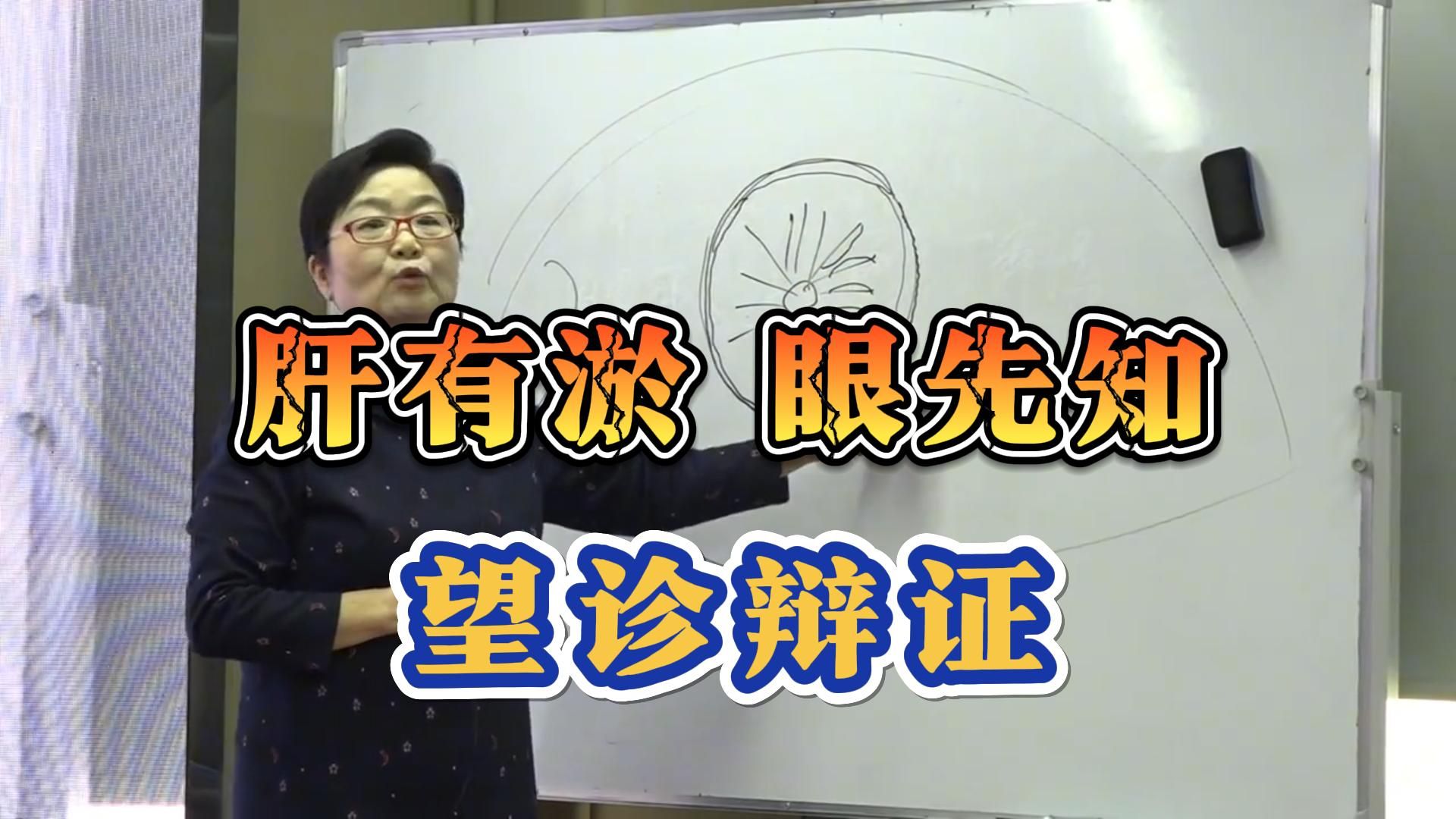 目诊:眼睛里出现这些情况,是肝有问题了!吕丽五维综合望诊哔哩哔哩bilibili