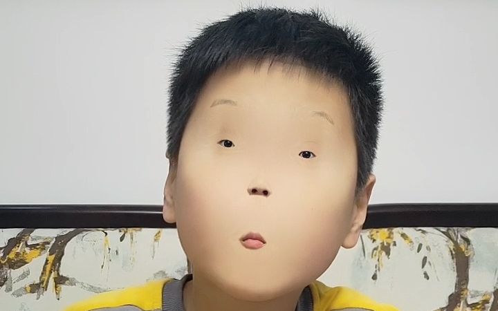 二宝的眼睛变小了