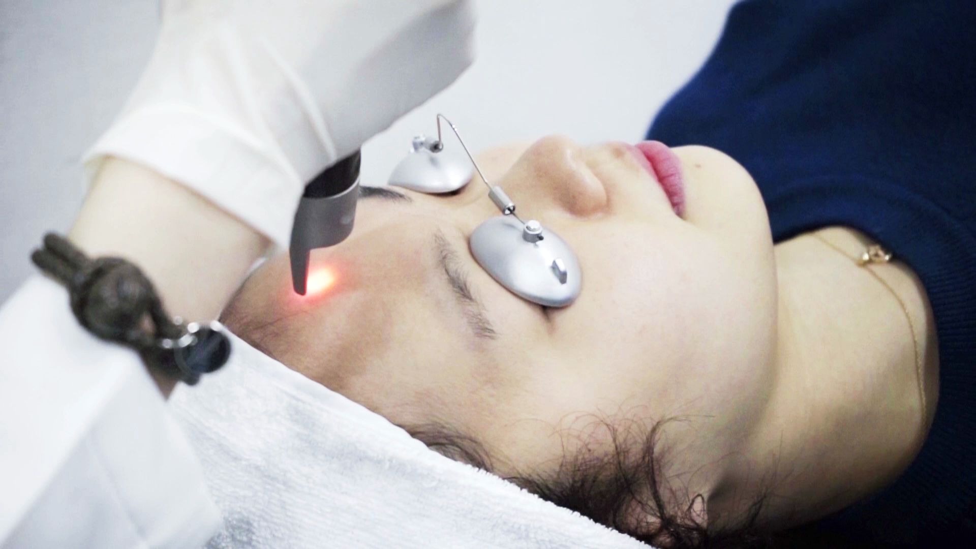 祛斑黑科技-蜂巢皮秒激光_哔哩哔哩 (゜-゜)つロ 干杯~-bilibili