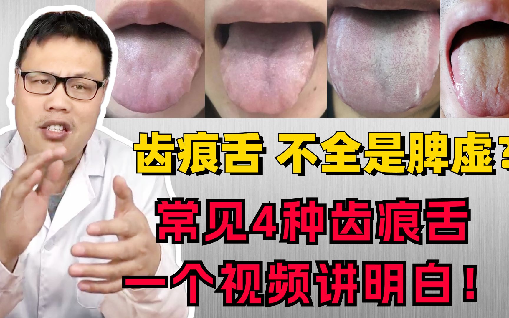 舌边有齿痕湿气重,不全是脾虚?常见的4种齿痕舌,一个视频讲明白!哔哩哔哩bilibili