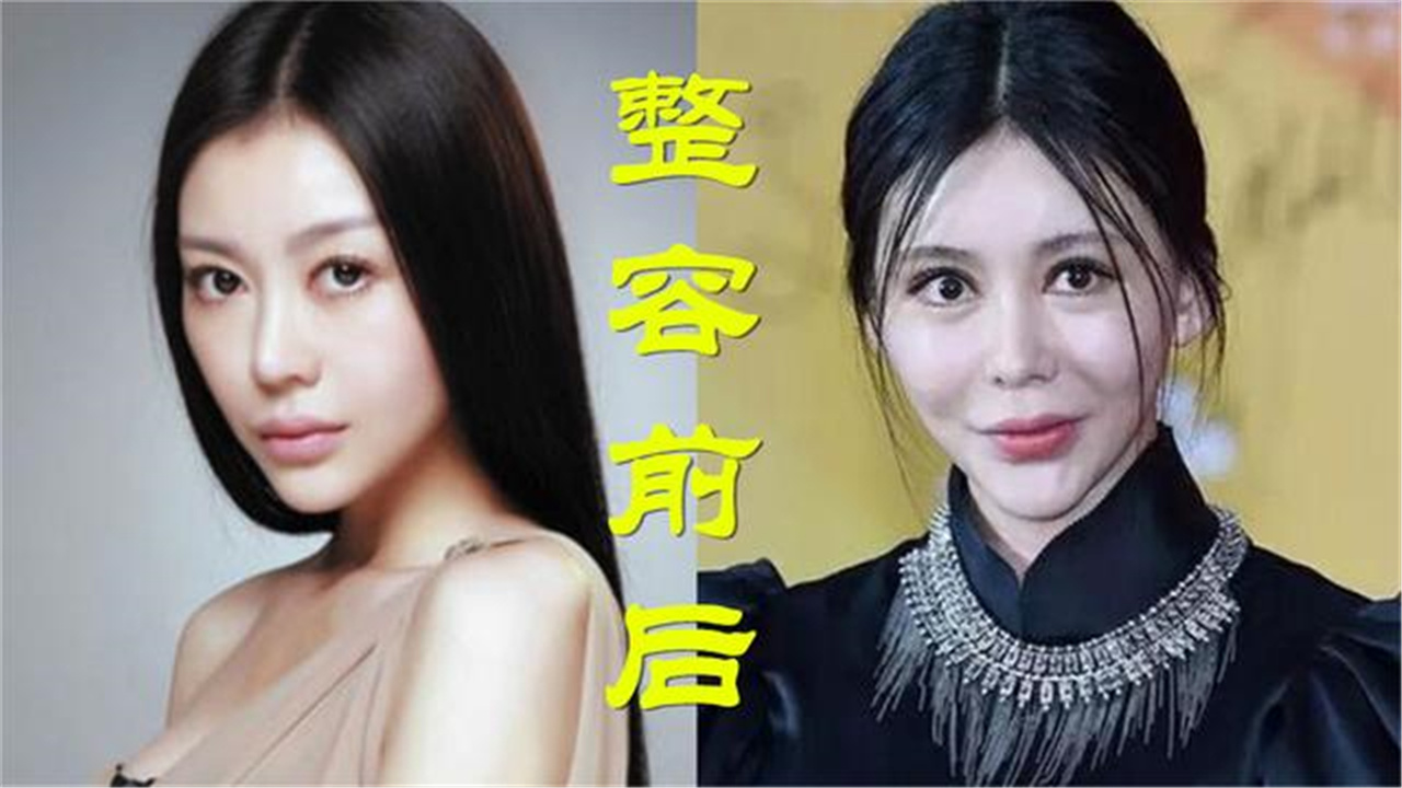 "整容失败"的女星,张檬"取出假体"重回巅峰,孙菲菲判若两人