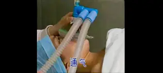 下载视频: 全身麻醉 教学视频 视频修复