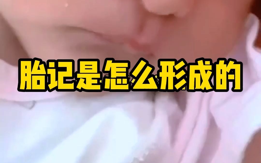 胎记是怎么形成的哔哩哔哩bilibili