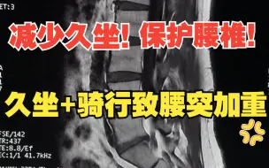 Descargar video: 减少久坐！保护腰椎！久坐+骑行导致腰突加重患者1例！