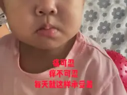 Скачать видео: 这只是个一岁多的孩子，需要做肝移植，每天受尽了痛苦折磨！愿你被这个世界温柔对待 少一些痛苦