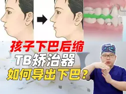 Download Video: 孩子下巴后缩，twin-block矫治器如何导出下巴？一次讲清楚