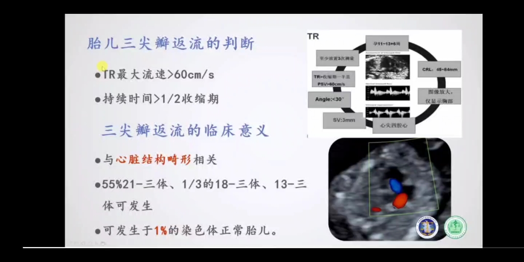 [图]早孕11-13+6W超声规范检查（基础章节—产科篇  第二讲）