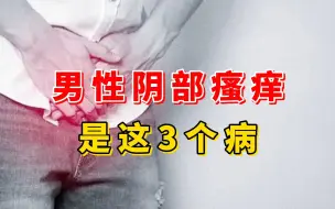 Download Video: 男科张广清：男性下面痒可能是这三种病