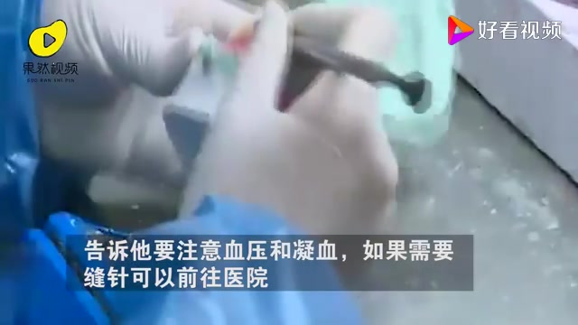 牙瞬间就不疼了!小伙拔牙10天后脑出血死亡,或因细菌感染引起哔哩哔哩bilibili