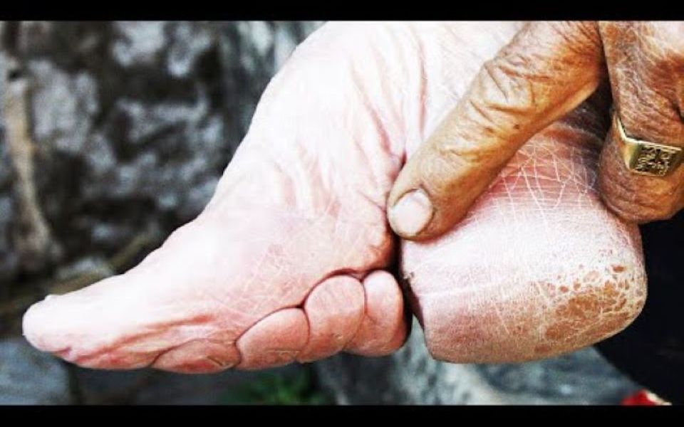 [图]【中英双语】The Horrors Behind Foot Binding 缠足背后的恐怖