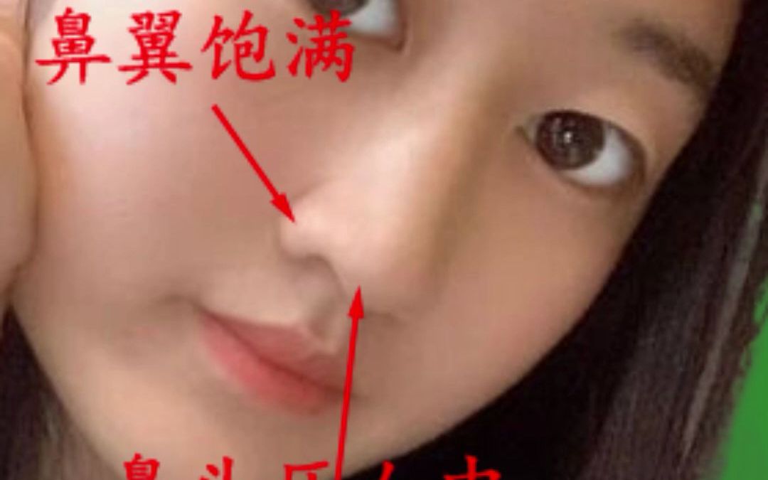 女人鼻头"压人中"会影响生育吗?