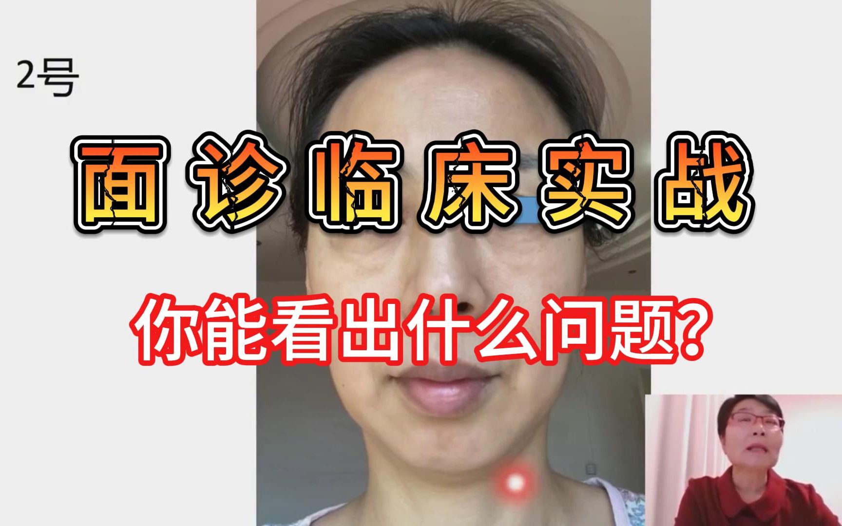 面诊临床实战,居然可以看出这么多身体问题!!!吕丽教你五维综合望诊面诊哔哩哔哩bilibili