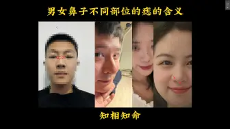 Download Video: 识人有术，男女鼻子不同部位痣的含义