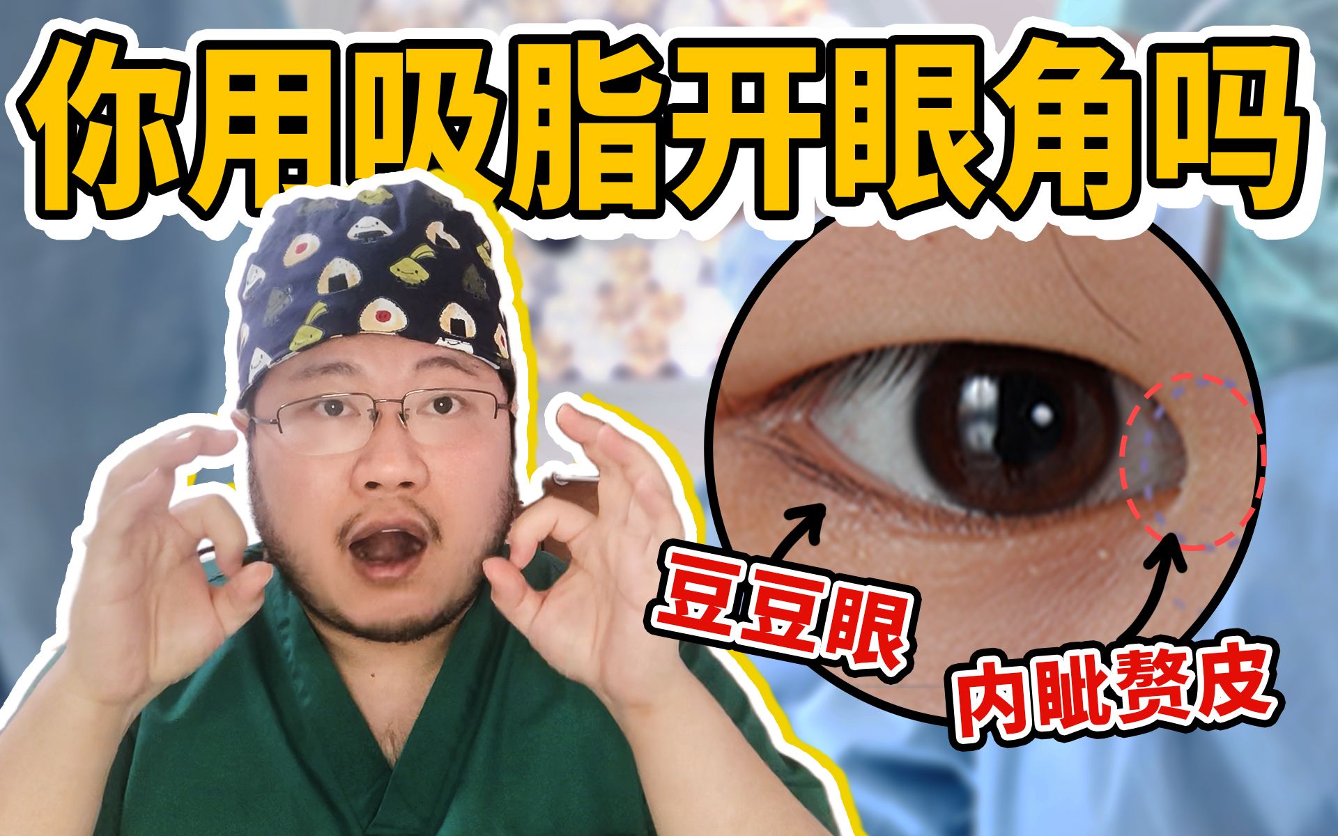 你真的适合做欧式大双?协和医生教你正确解决蒙古眼/内眦赘皮|医美科普哔哩哔哩bilibili