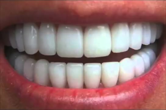 Get Perfectly Straight Teeth affirmations Cure Overbite Underbite哔哩哔哩bilibili