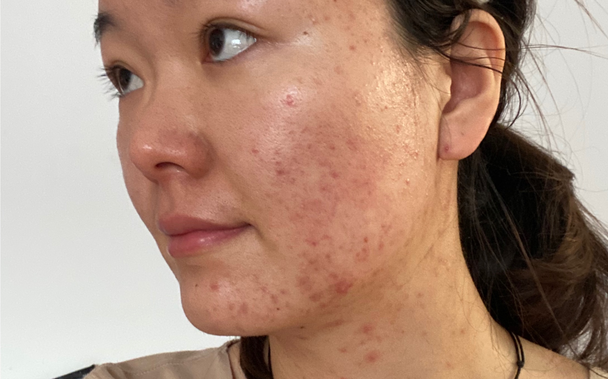 无美颜|无滤镜|痘痘痘印|瑕疵皮,如果拥有一个完美无暇的妆容!