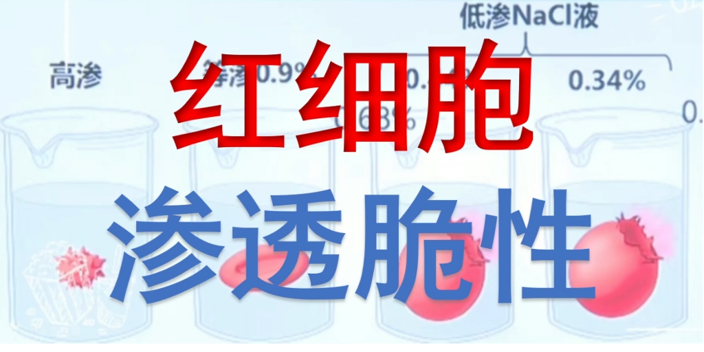 红细胞渗透脆性红细胞低渗溶液高渗溶液等渗溶液哔哩哔哩bilibili