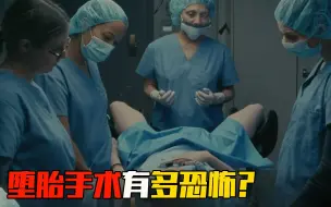 Descargar video: 堕胎手术有多恐怖？看完这个视频，你还敢为爱流产吗？