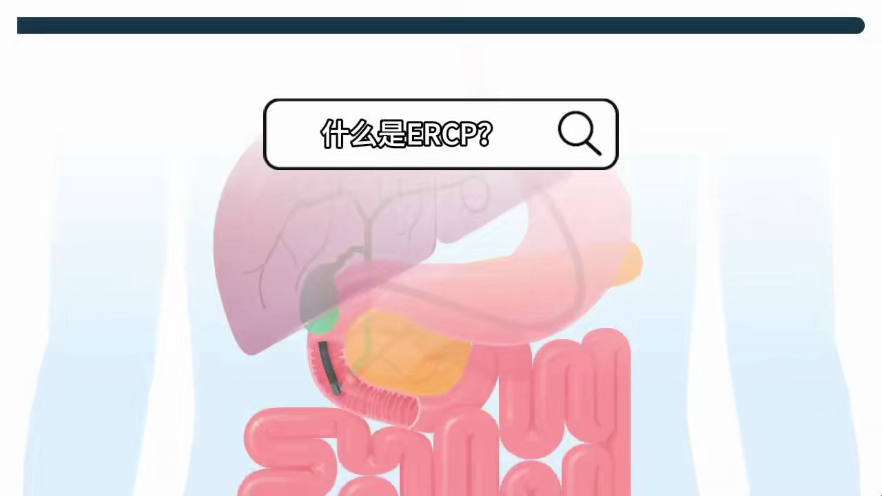 科普动画:六分钟深入浅出带你了解ERCP(内含有中文配音)哔哩哔哩bilibili