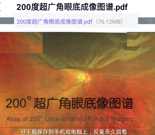 200度超广角眼底成像图谱欧堡眼底图像谱眼底照相眼科电子版文档