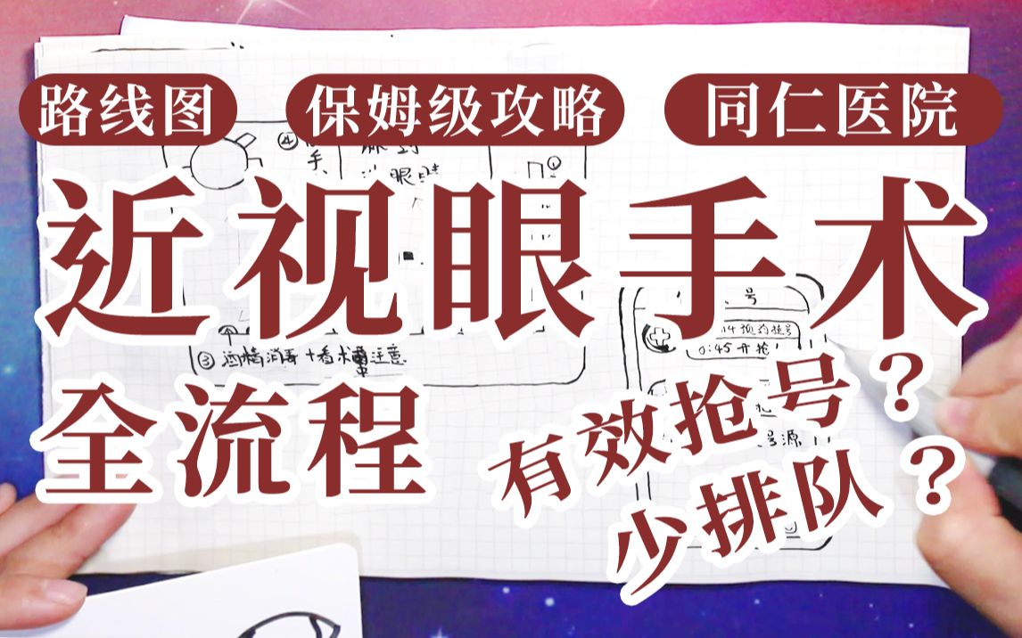 【亲身经历】同仁医院做近视眼手术难在哪?简笔画手带你做完全飞秒 |从检查到术后|保姆级教程哔哩哔哩bilibili