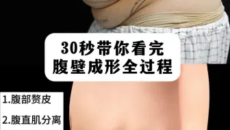 30秒带你看完腹壁成形全过程