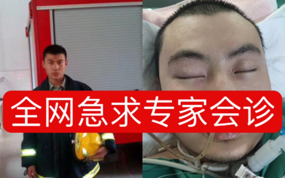 [图]截瘫消防员急需救命治疗，全网寻找这几位医生教授！！！