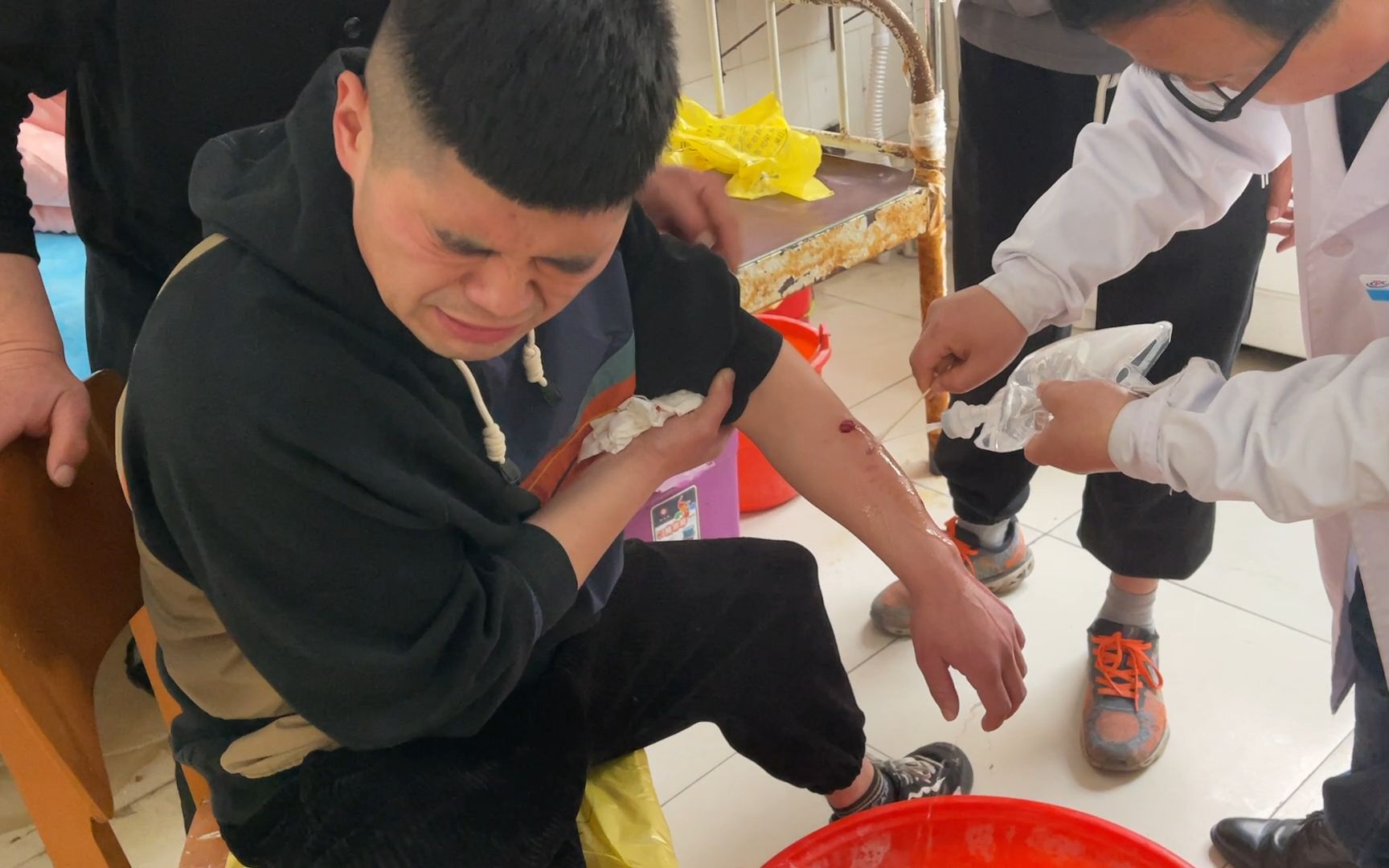 姚三马被恶狼咬伤23天后,胳膊上竟留下个牙窟窿,看着真吓人!