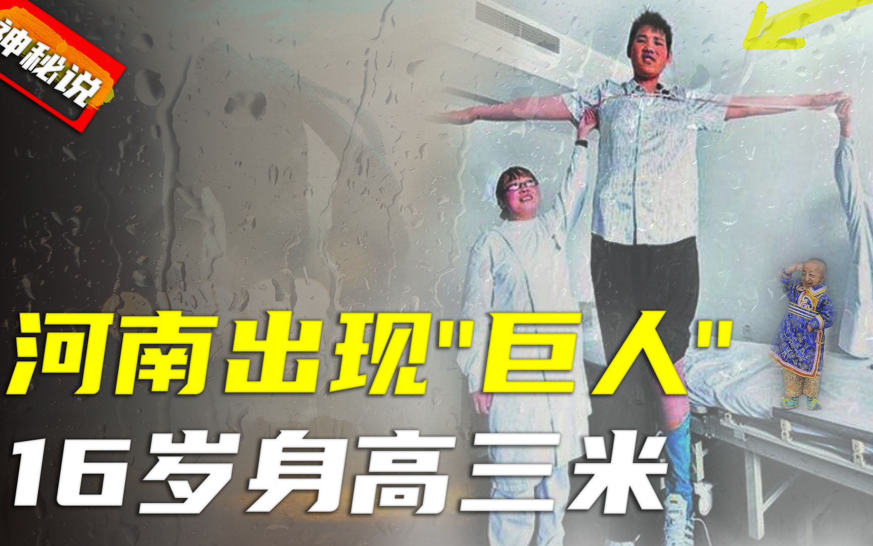 活动作品河南老夫妇生下巨人十六岁身高直逼三米医生见了都害怕
