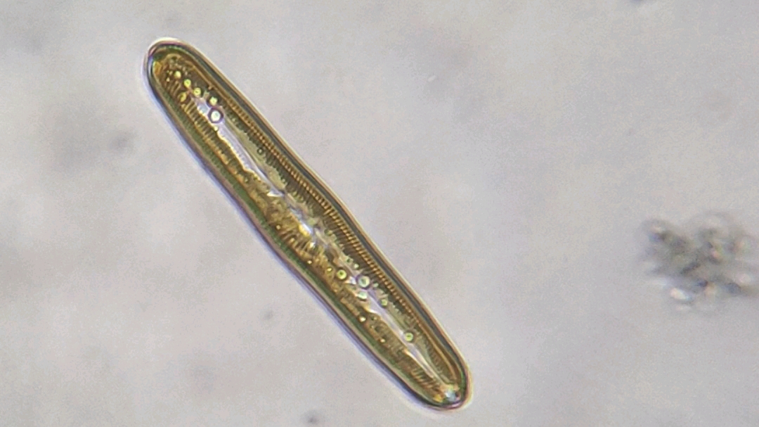 池塘里的微生物目测是硅藻