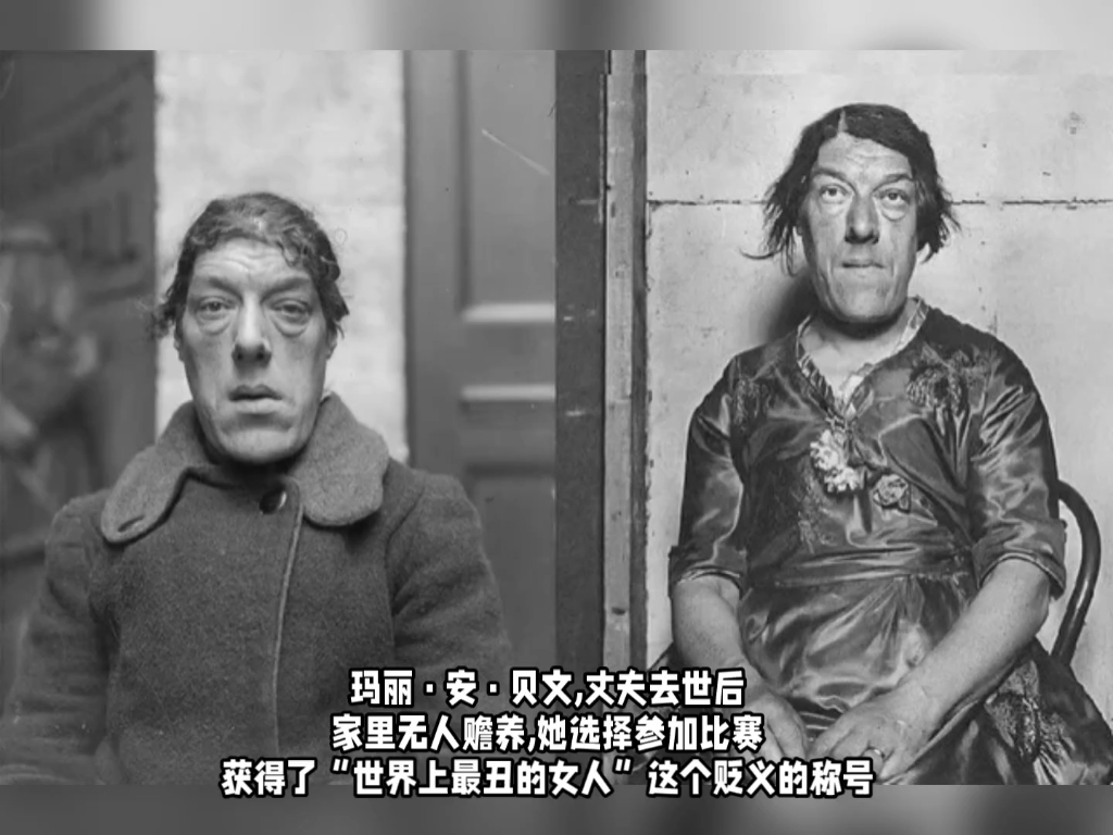 世界上"最丑"的女人