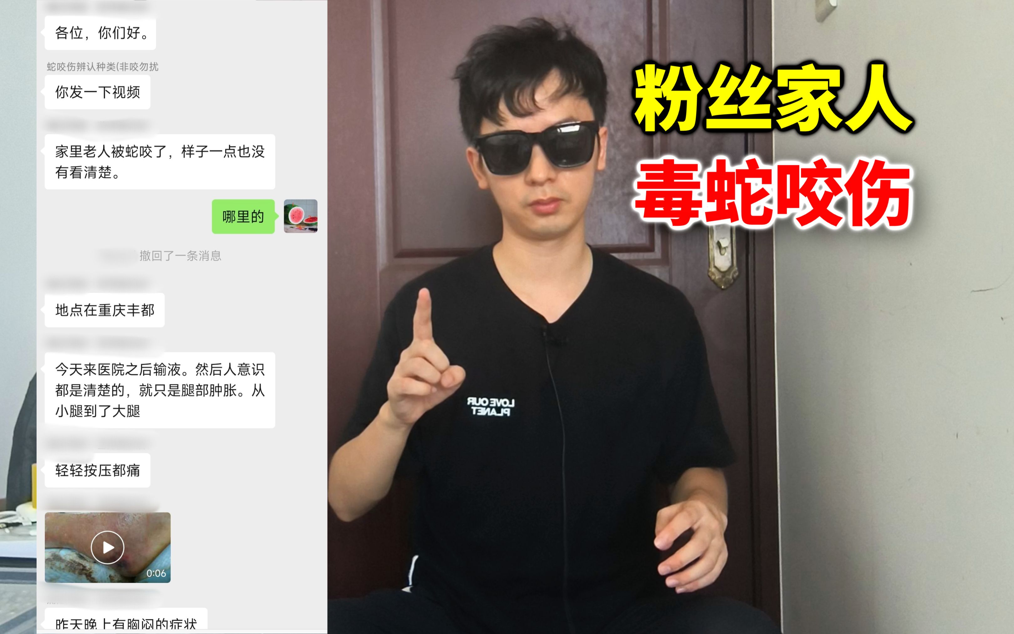 [图]重庆的粉丝家人被毒蛇咬伤！没有看到蛇！医生不知道用什么血清？