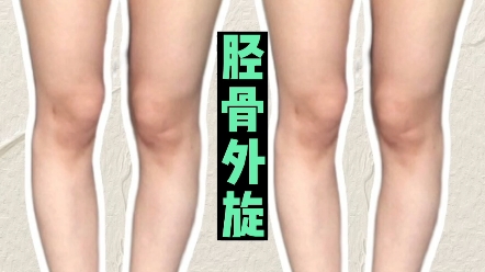 【胫骨外旋】为什么要强化腘肌?腿型矫正!