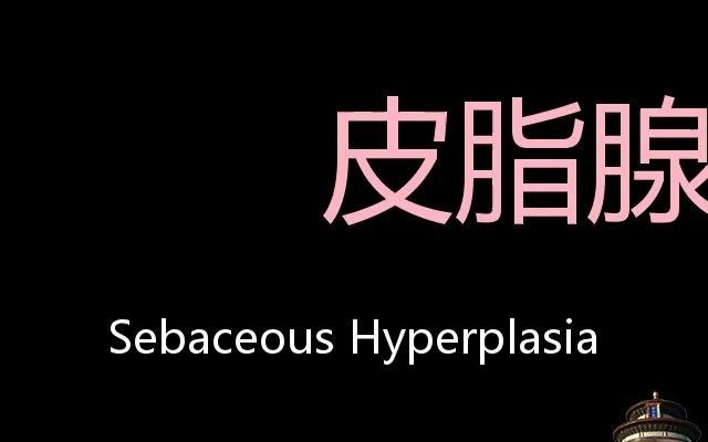 皮脂腺肥大 Chinese Pronunciation Sebaceous Hyperplasia哔哩哔哩bilibili