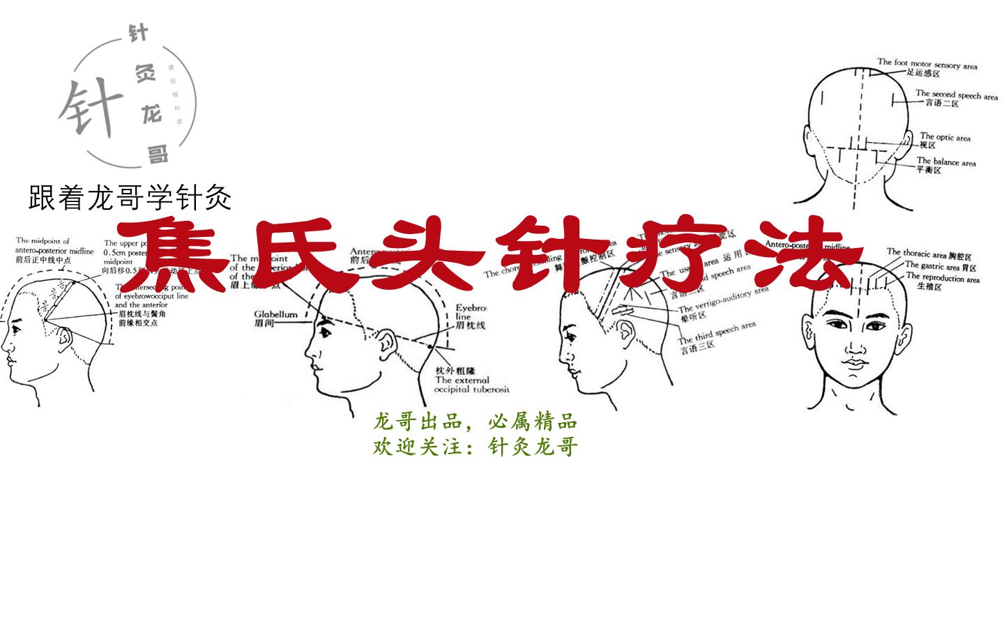 跟着龙哥学针灸(六):焦氏头针疗法简介哔哩哔哩bilibili