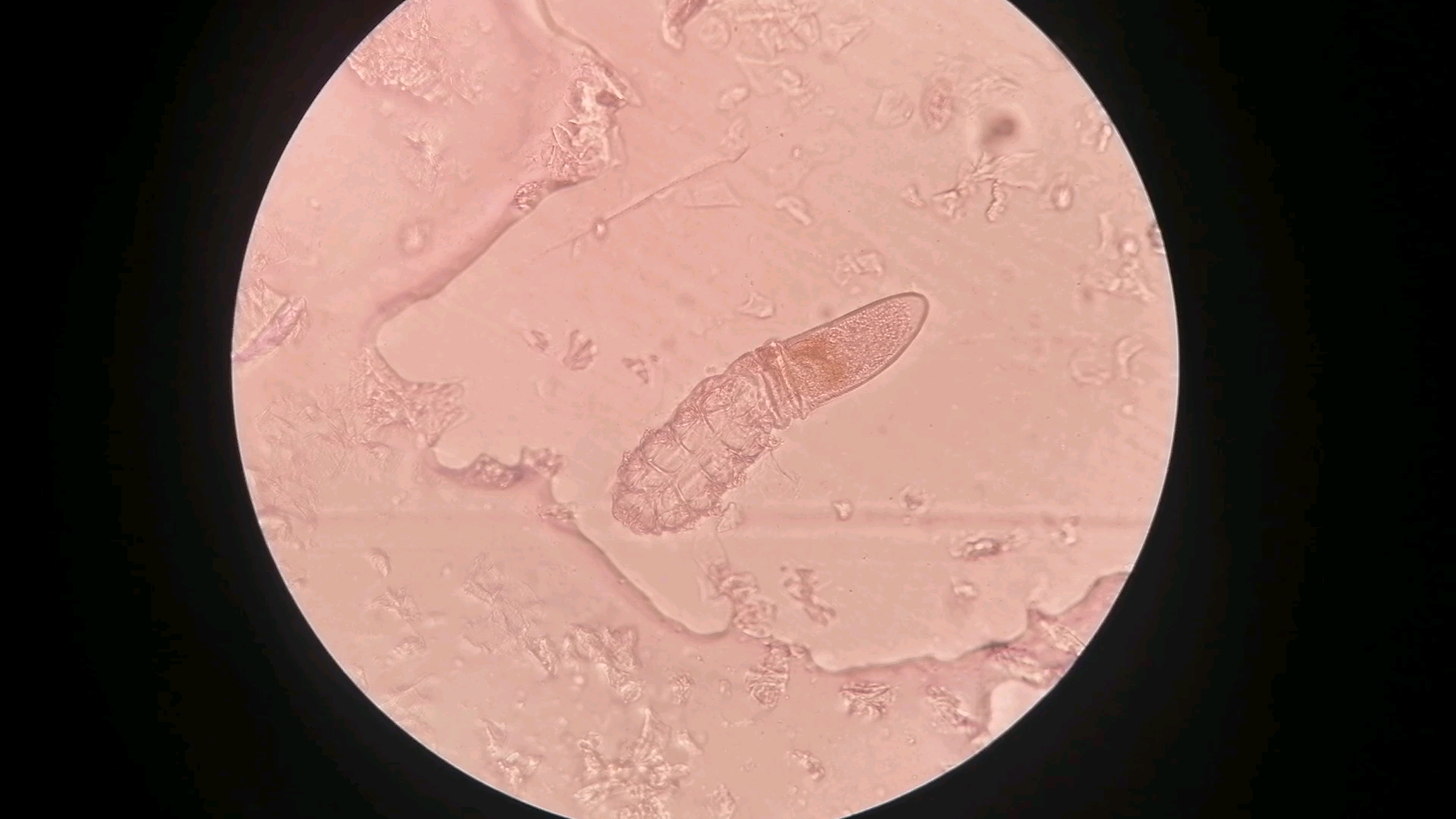 显微镜下的螨虫脸上图片