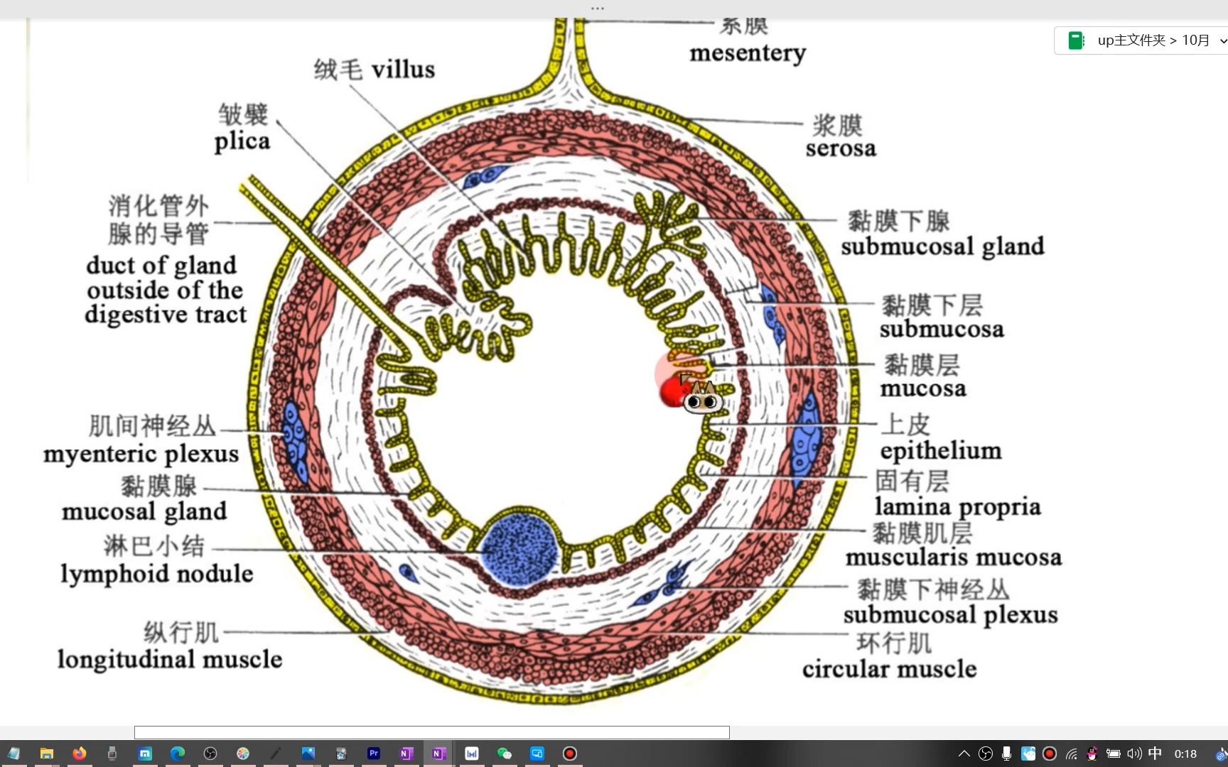 消化系统肿瘤的病理分型(内含原位癌、黏膜内癌、粘膜下癌的概念辨析)哔哩哔哩bilibili