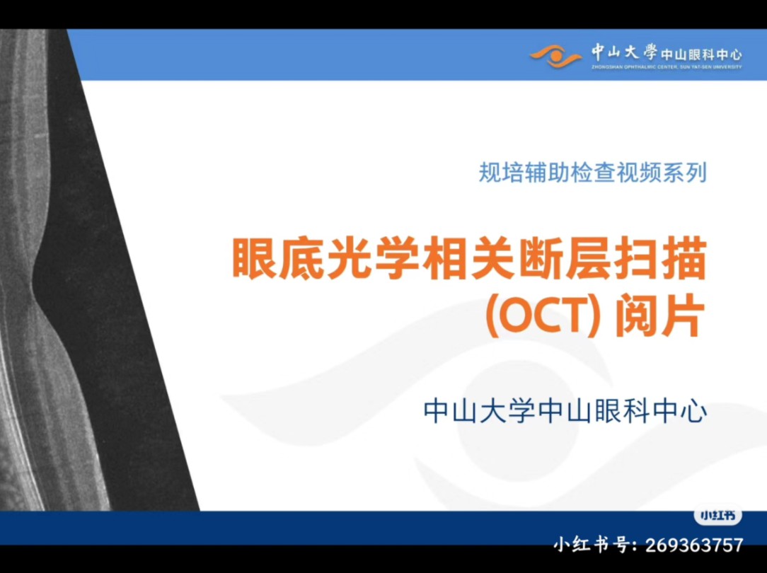 眼底OCT阅片(下)哔哩哔哩bilibili