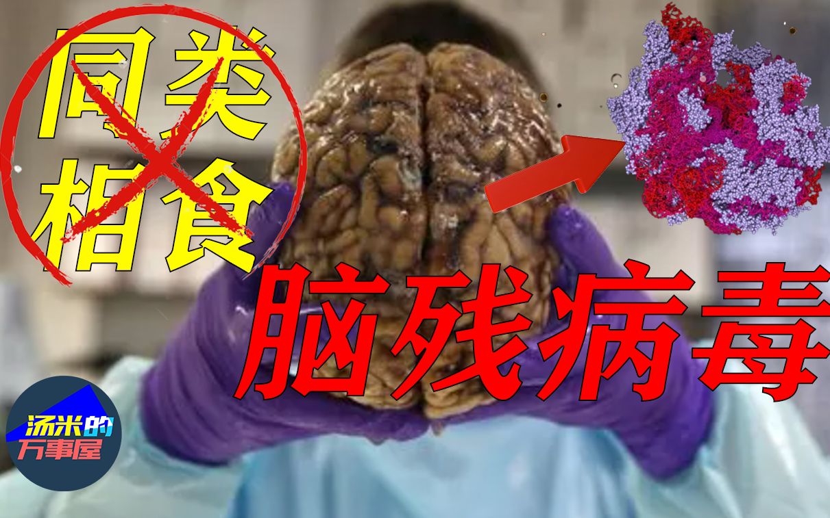 [图]神圣诅咒：为防止人吃人，上帝创造出致死率100%的朊病毒