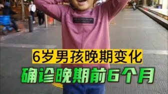 Video herunterladen: 6岁确诊晚期的前后变化