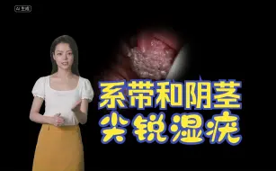 Download Video: 男性系带、阴茎尖锐湿疣症状图片 - 医学科普 |有图有真相